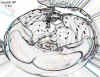 boob26E1W.jpg (41454 bytes)